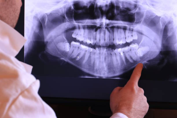 Best Tooth Infection Emergency Dentist  in Woodruff, SC